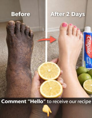 How I Improved the Appearance of My Legs: Smoother, Brighter & Healthier-Looking Skin with Simple Habits