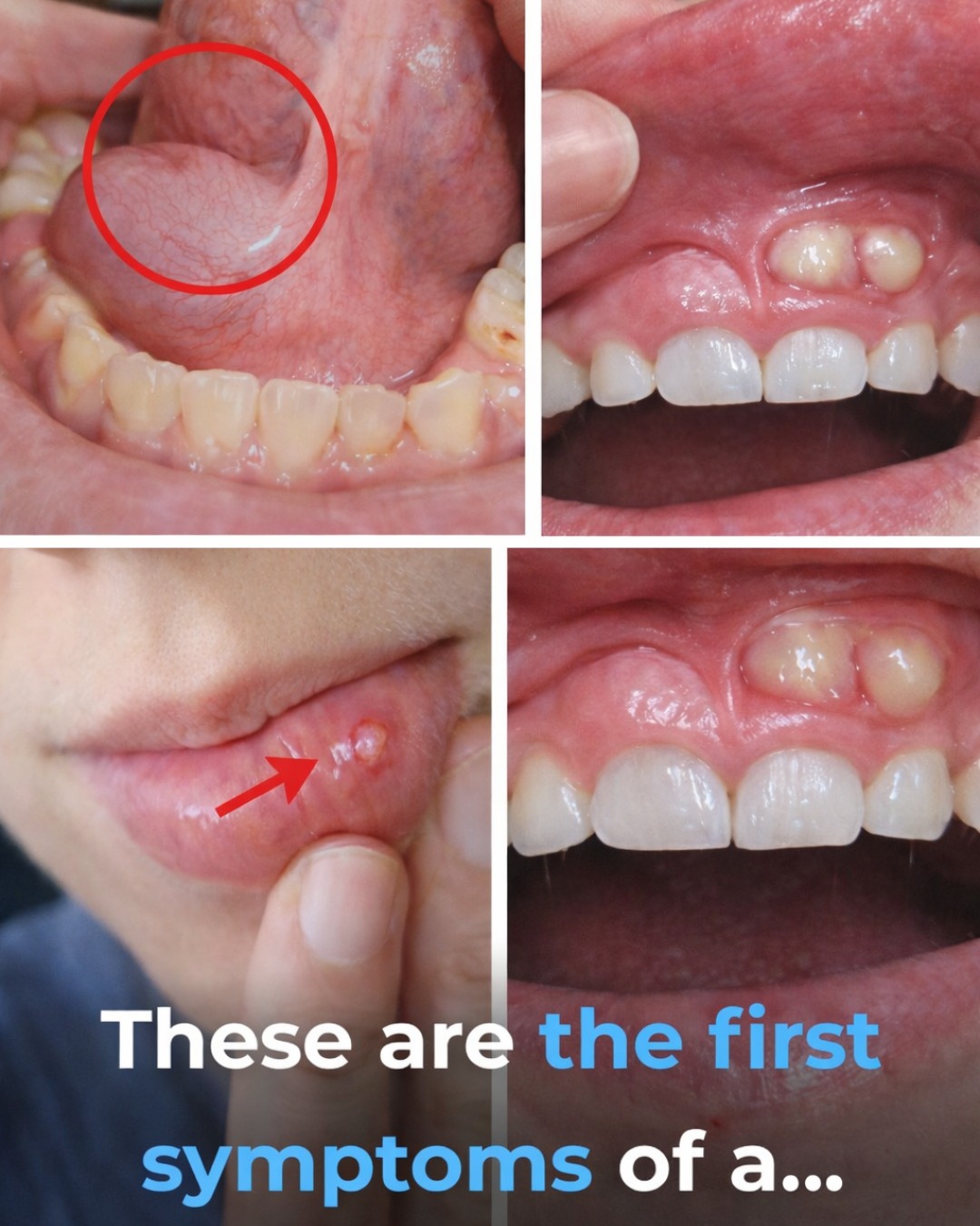 7 Early Signs of Oral Cancer You Should Never Ignore