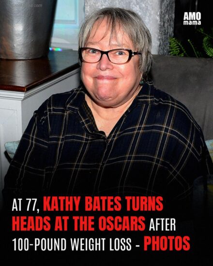 Kathy Bates Makes a Splash at 77 Looking Better than Ever – Inside Her 100-Pound Weight Loss Transformation